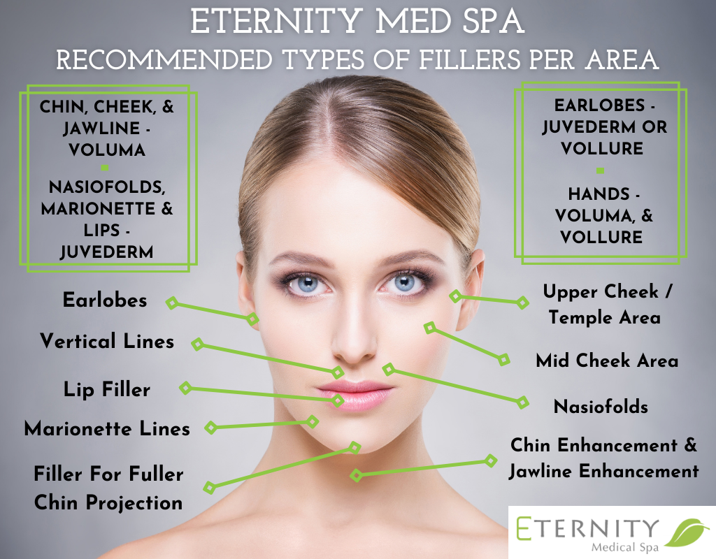 Cosmetic Fillers Creve Coeur, Chesterfield, & O'Fallon, MO | Eternity Med Spa