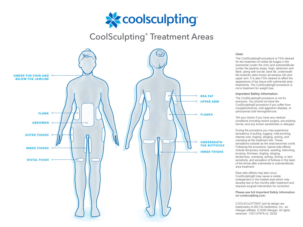 CoolSculpting Treatment Creve Coeur, MO | Eternity Med Spa | Body Sculpting Creve Coeur